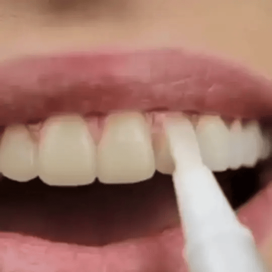 SmileFitPro™ Teeth Whitening Pen